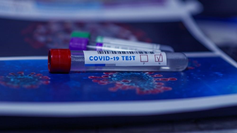 Prostovoljno in brezplačno testiranje na SARS-CoV-2 s hitrimi antigenskimi testi
