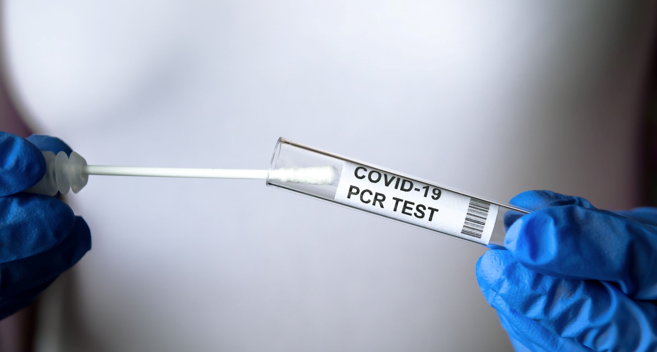 SAMOPLAČNIŠKO PCR TESTIRANJE NA SARS-COV-2 V ZD CELJE